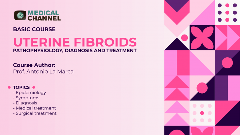 Uterine Fibroids. Pathophysiology, diagnosis and treatment