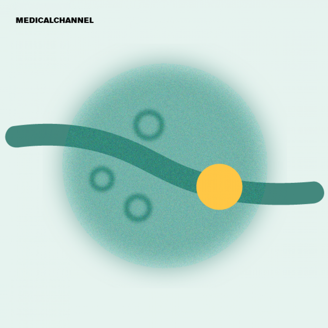 Deucravacitinib in Plaque Psoriasis